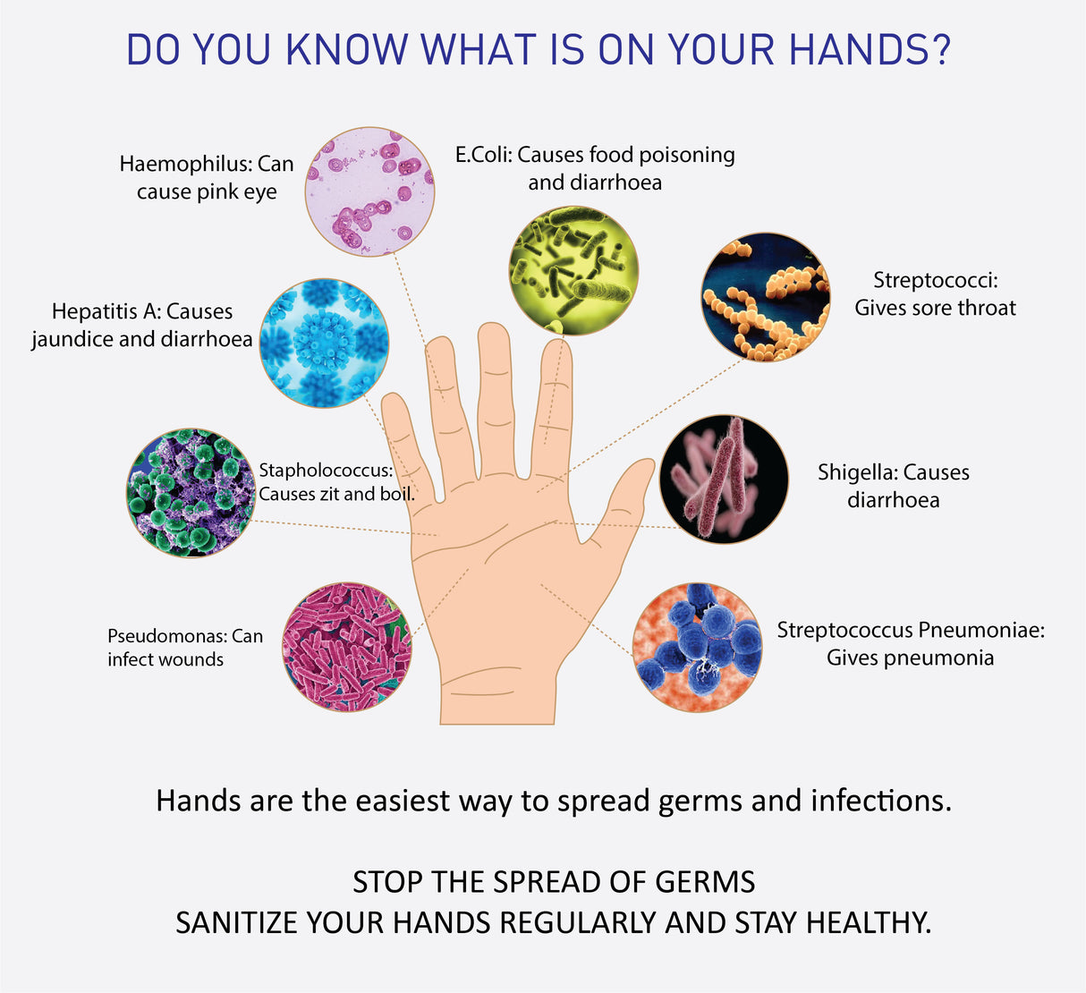MaxShield® Hand Sanitizer Gel  Cartridges - Alcohol Hand Rub 6 x 800ml