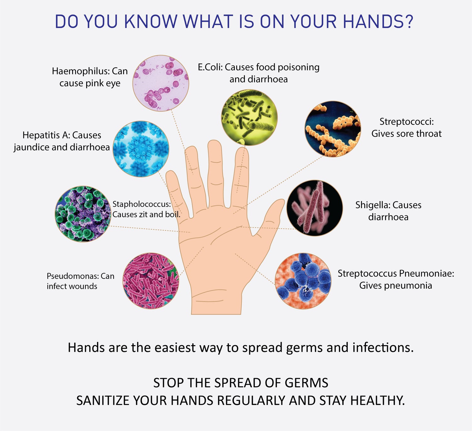 MaxShield® Hand Sanitizer Gel  Cartridges - Alcohol Hand Rub 6 x 800ml